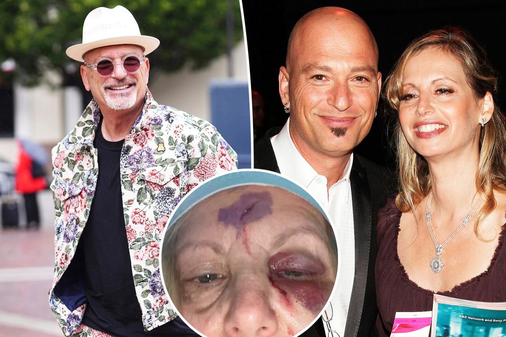 Howie Mandel giải thích rằng vợ đã nghiện đồ ăn trước khi tìm thấy cô ấy trong vũng máu với hộp sọ lộ ra ngoài