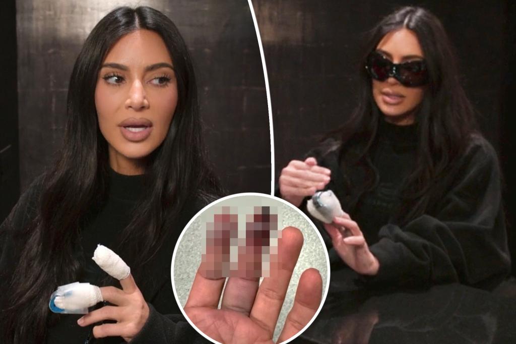 Kim Kardashian cho biết cửa trượt gây thương tích cho ngón tay