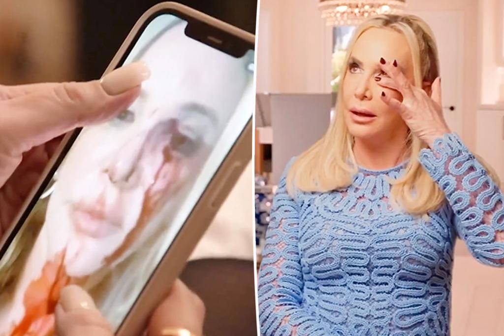 Shannon Beador ‘sốc’ vì bức ảnh tự sướng đẫm máu sau khi bị bắt vì lái xe khi say rượu