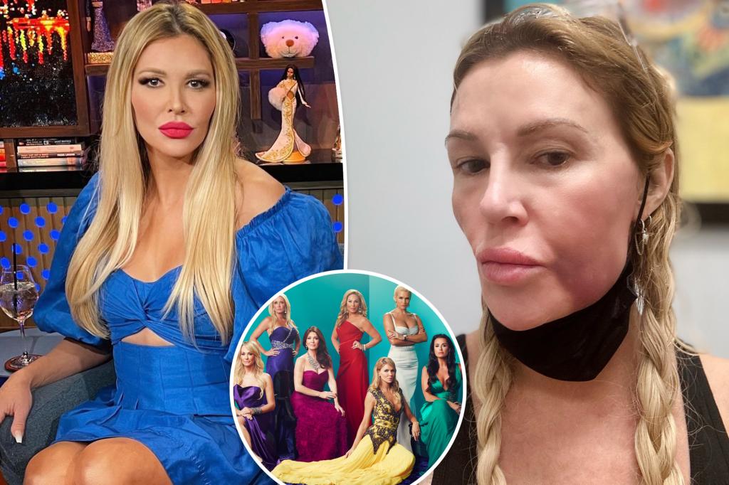 Brandi Glanville đổ lỗi cho Bravo về tình trạng sưng mặt nghiêm trọng