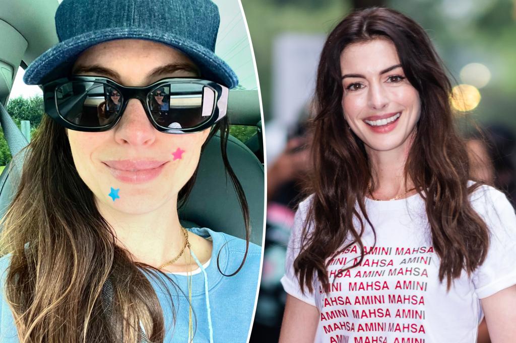 Anne Hathaway khoe mảng mụn trong bức ảnh tự sướng không trang điểm: ‘Giống như chúng ta’