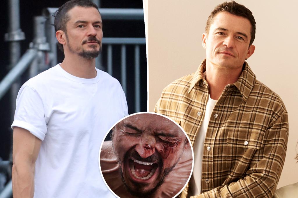 Orlando Bloom nghĩ rằng anh ấy sẽ ‘chết’ vì giảm cân quá nhiều để vào vai trong phim