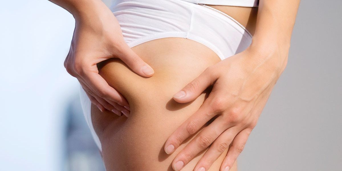 Bác sĩ phẫu thuật thẩm mỹ chia sẻ những cách tốt nhất để giảm cellulite mà không cần phẫu thuật – Cuộc sống tốt nhất